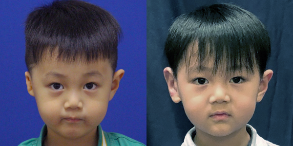 XC_B&A_AP